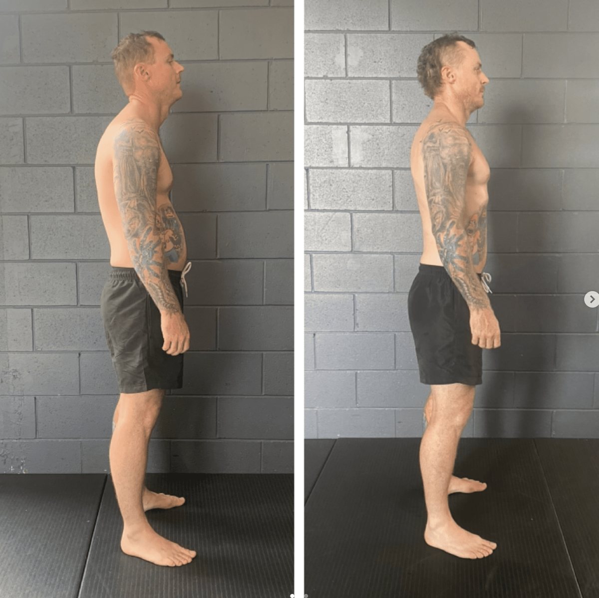 Deep Tissue Massage Gold Coast: Why It Might Not Be Enough