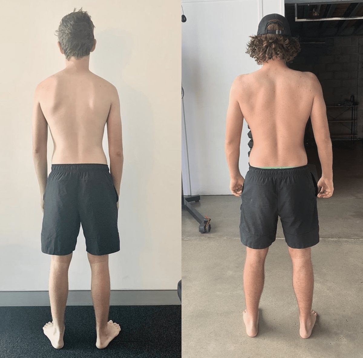 Functional patterns shoulder result