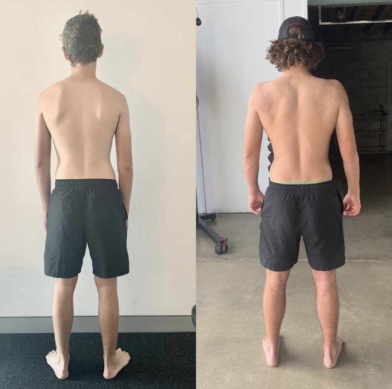 How to Fix Posture with Functional Patterns