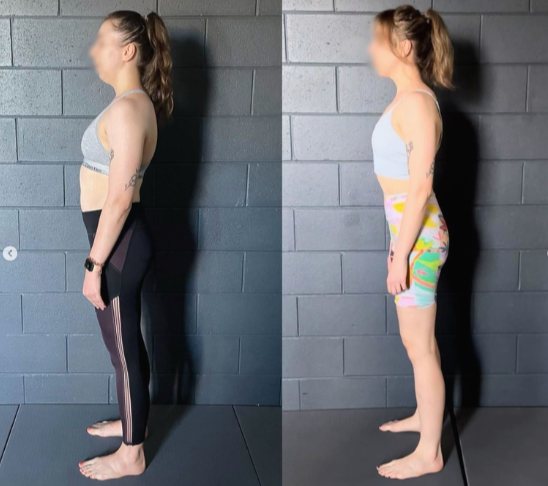5 Effective Strategies to Combat Chronic Poor Posture – Gold Coast Style