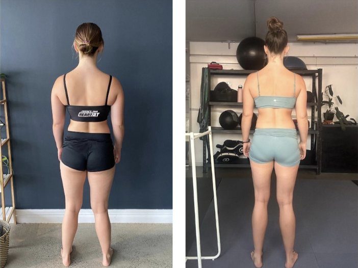 hypermobility exercise gold coast Burleigh
