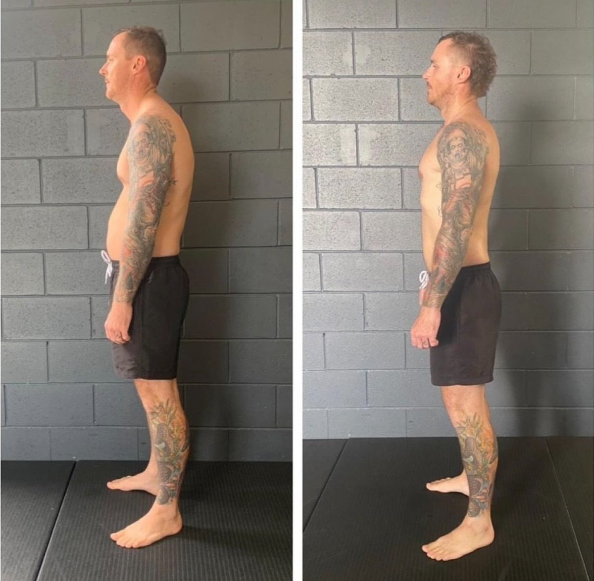 Posture specialist functional patterns gold coast