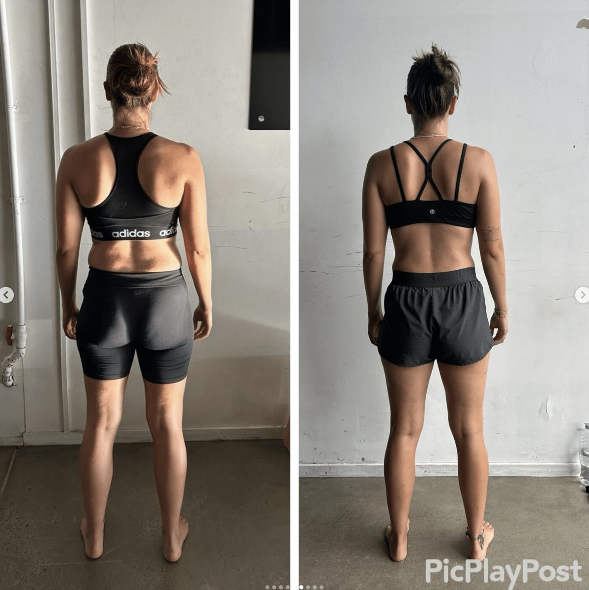 tight fascia how to fix