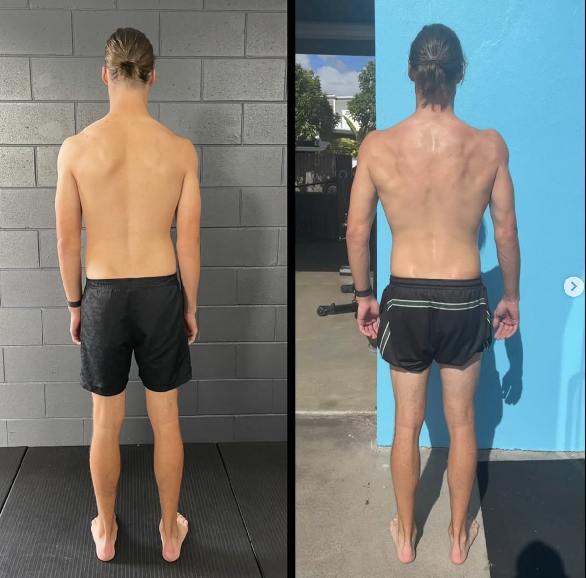 massage therapist gold coast