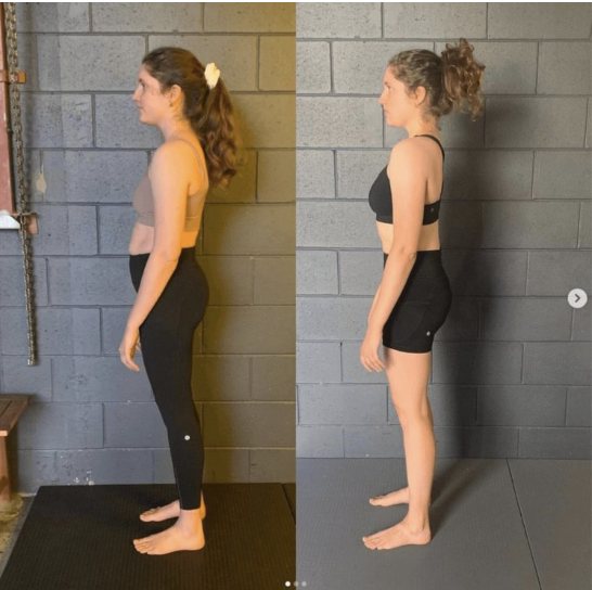 Posture specialist functional patterns gold coast