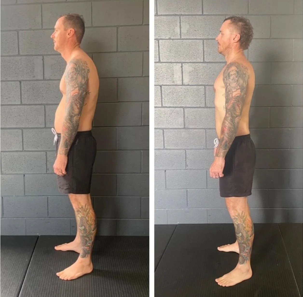 Before and after posture transformation at Functional Patterns Burleigh