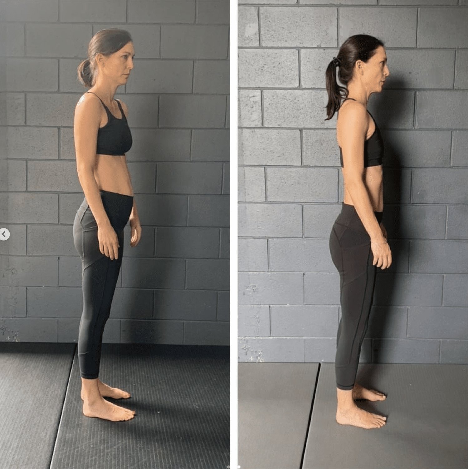 Before and after posture correction result — Functional Patterns Burleigh