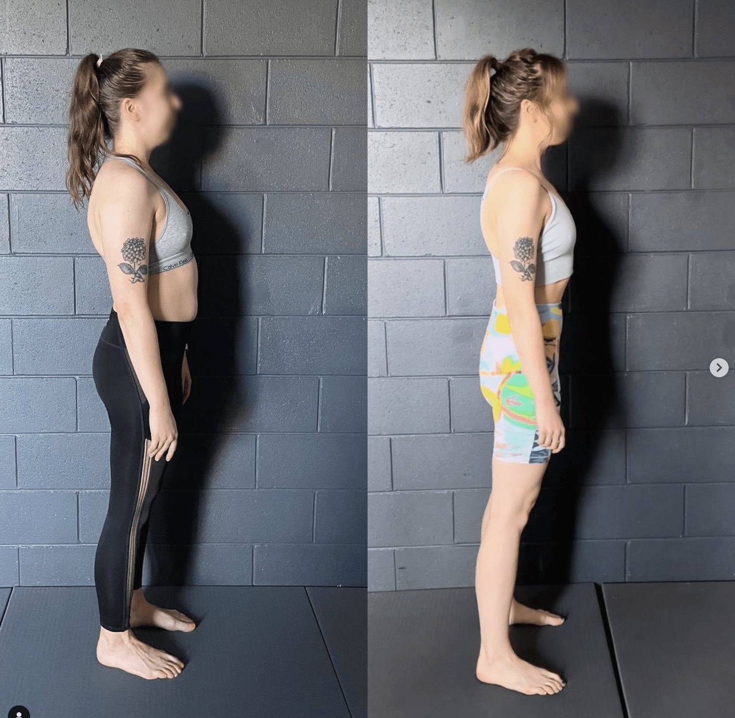 Before and after posture correction result — Functional Patterns Burleigh