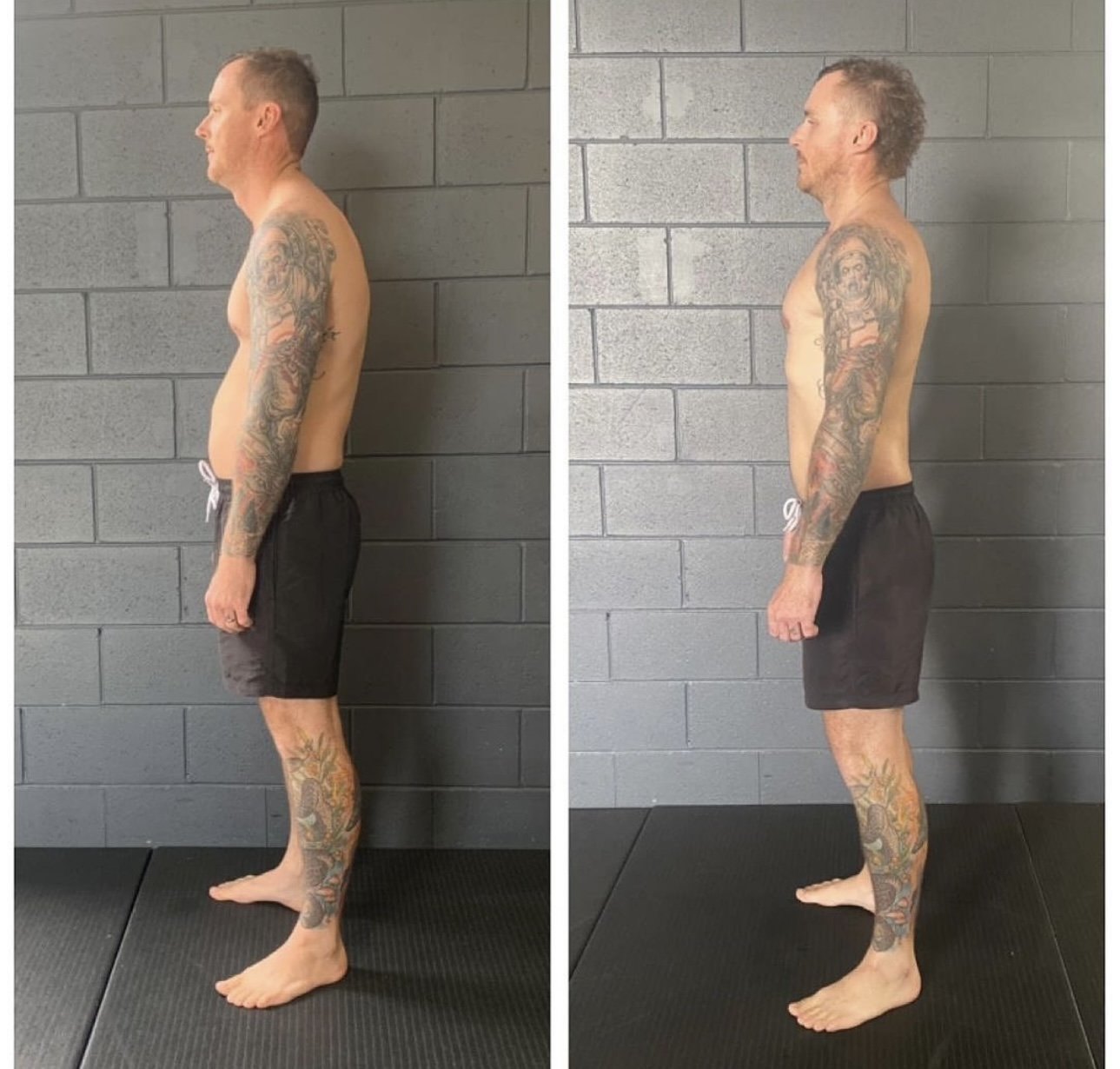 Before and after posture transformation — Functional Patterns Burleigh