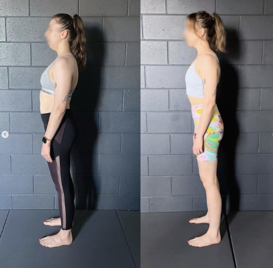 Before and after transformation with Functional Patterns — Burleigh Biomechanics