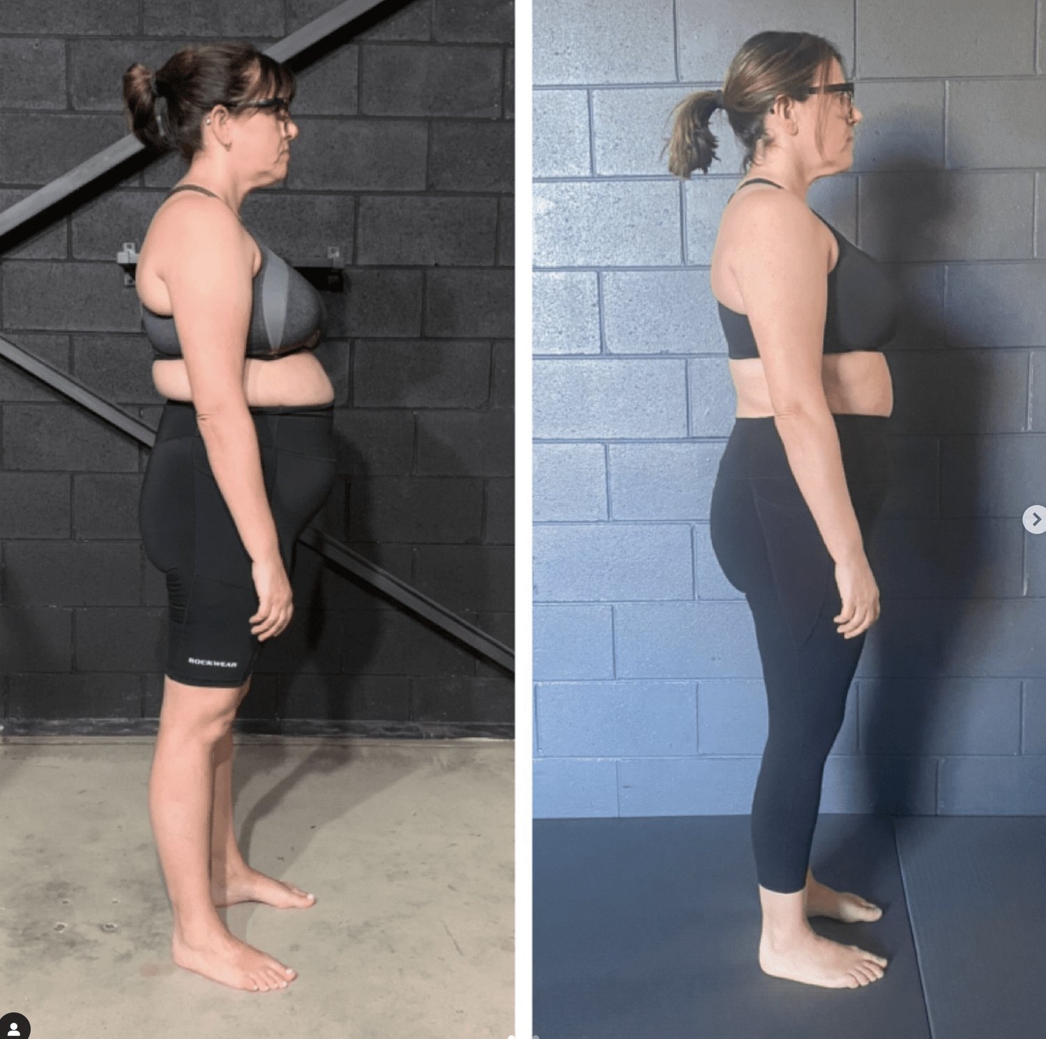 Posture correction before and after — Functional Patterns Gold Coast