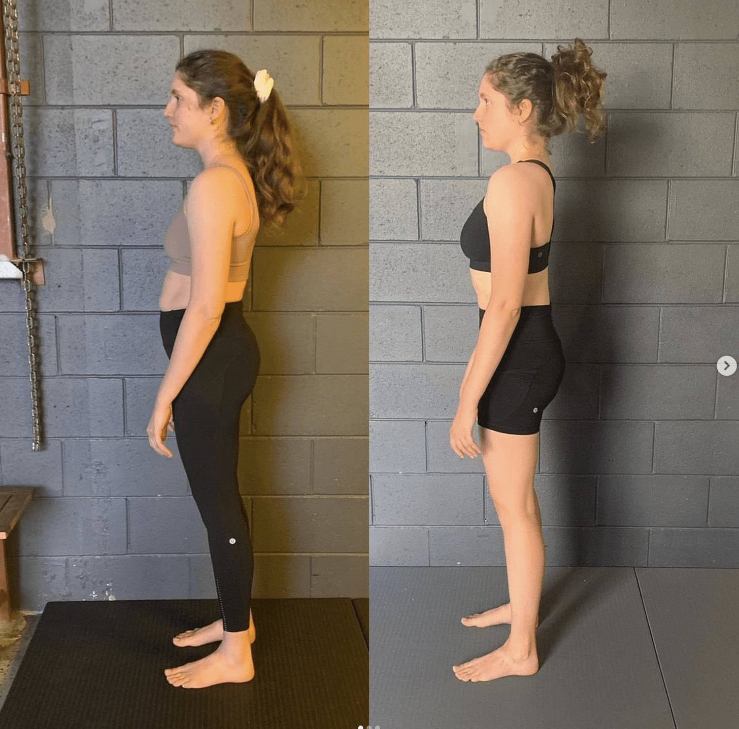 Posture correction before and after — Functional Patterns Gold Coast