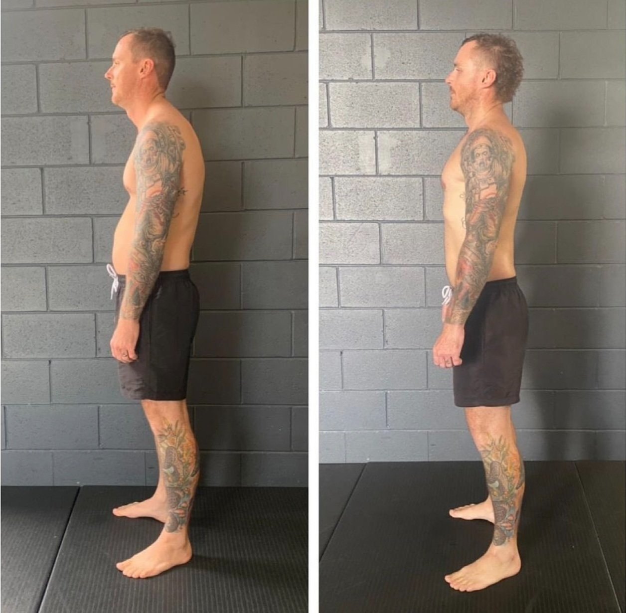 8-month posture correction result for Jen's client Matt — Functional Patterns Burleigh
